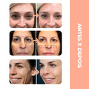 GlowUp™ - Massageador Facial Rejuvenescedor Elimina Rugas e Papadas