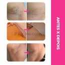 Depilana™ - Depiladora 5 em 1 + Creme O Boticário de brinde para as 100 primeiras