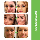 Moisture® - Base À Prova D'Água Remove Todas Manchas e Expressões (+ Esponja Cogumelo de Brinde)